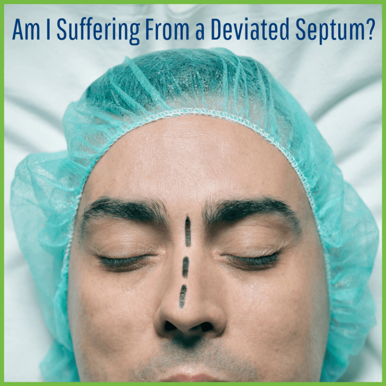 Deviated deals septum symptoms