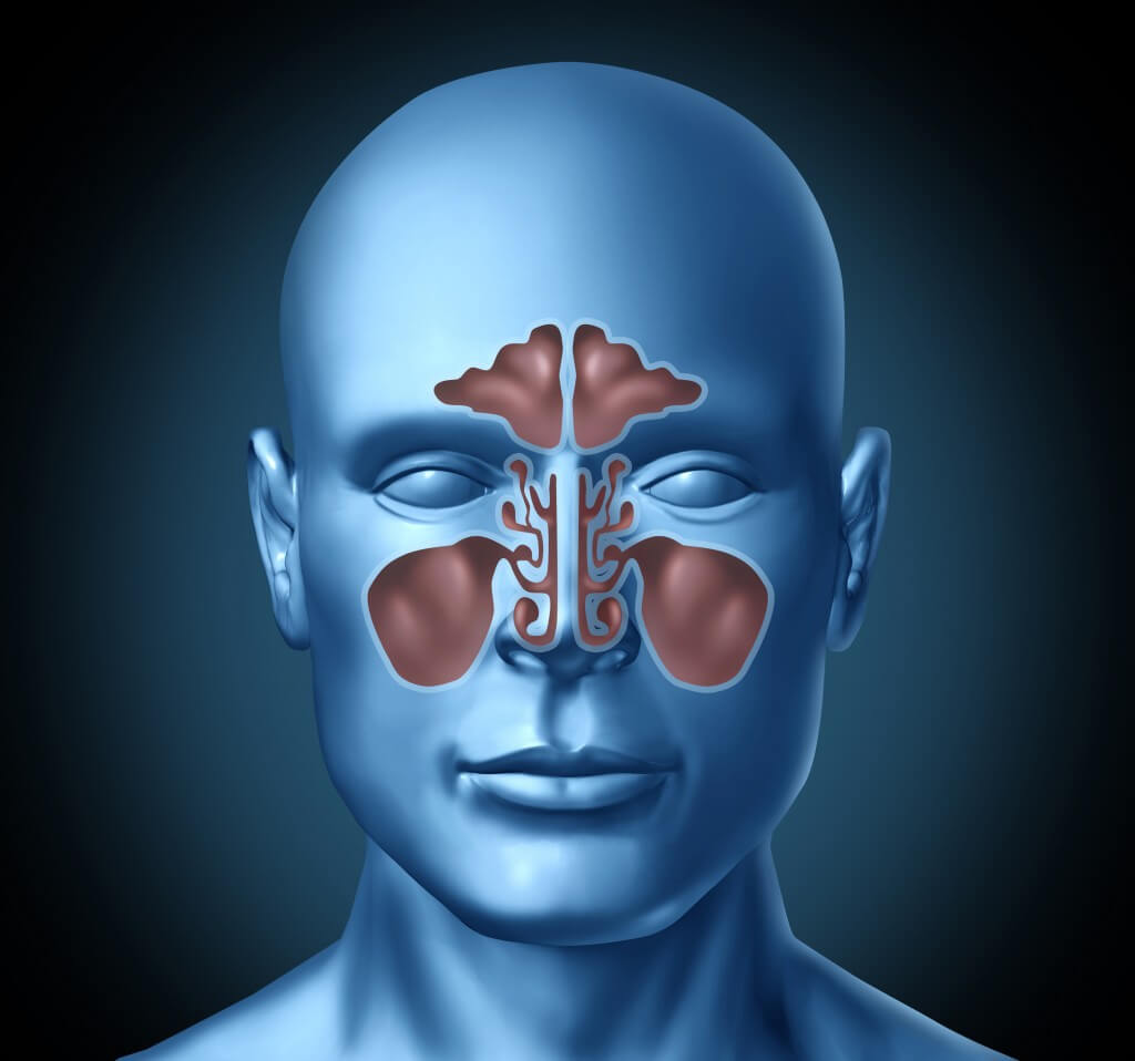 Acute Sinusitis Causes Symptoms and Treatment Options Houston