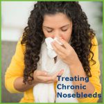 Understanding and Treating Chronic Nosebleeds - Houston Advanced Sinus