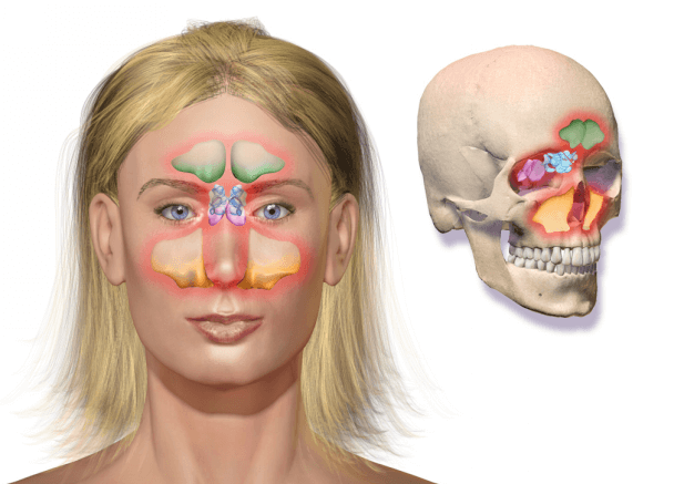 sphenoid sinus tumours