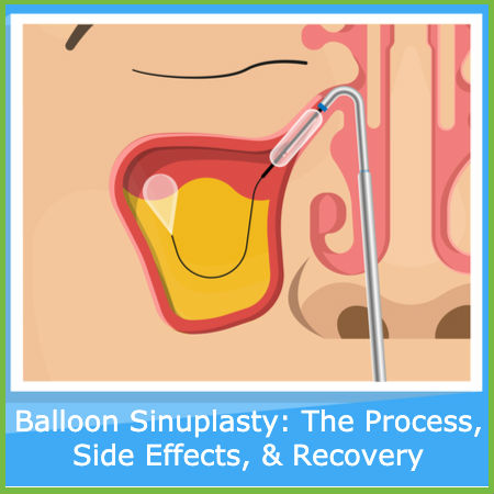 Risks and rewards of nasal rinses: What you need to know