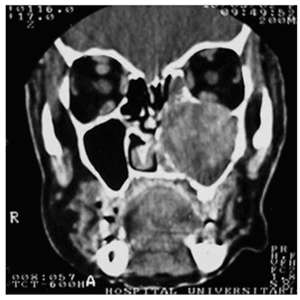 sinus x ray